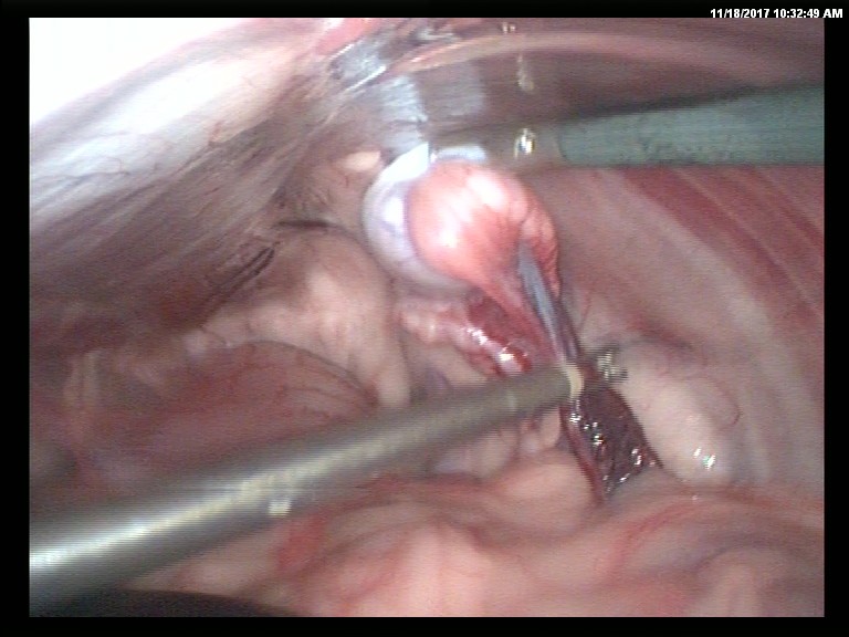 surgery-4